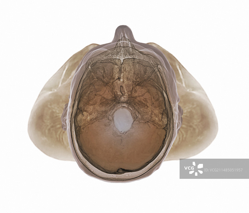 人头3D CT扫描图片素材