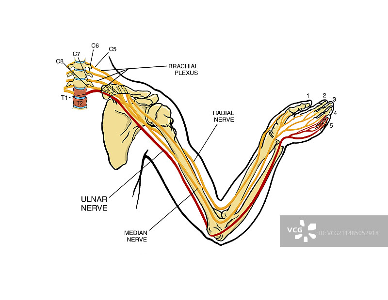 臂丛神经损伤图片素材