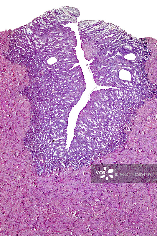 人类子宫显微照片图片素材