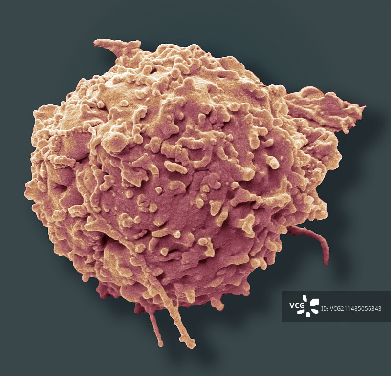 嗜酸性粒细胞扫描电镜图图片素材