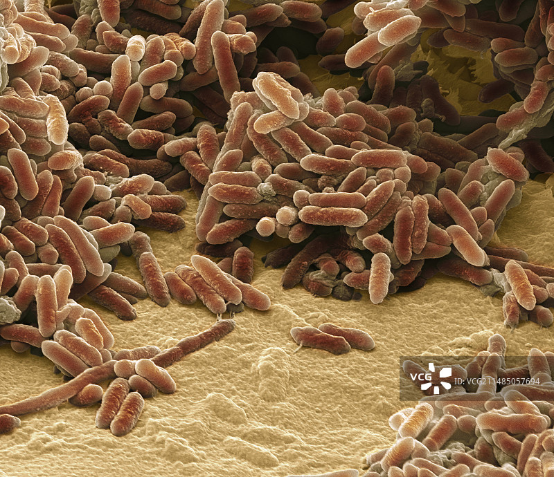 水螺旋菌（扫描电镜图）图片素材