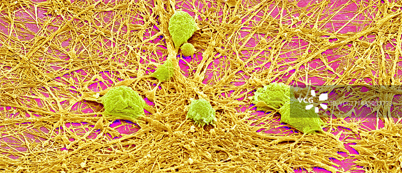 神经系统细胞扫描电镜图图片素材