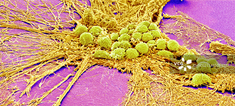 神经系统细胞扫描电镜图图片素材