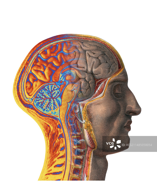 大脑，历史艺术品和核磁共振扫描图片素材