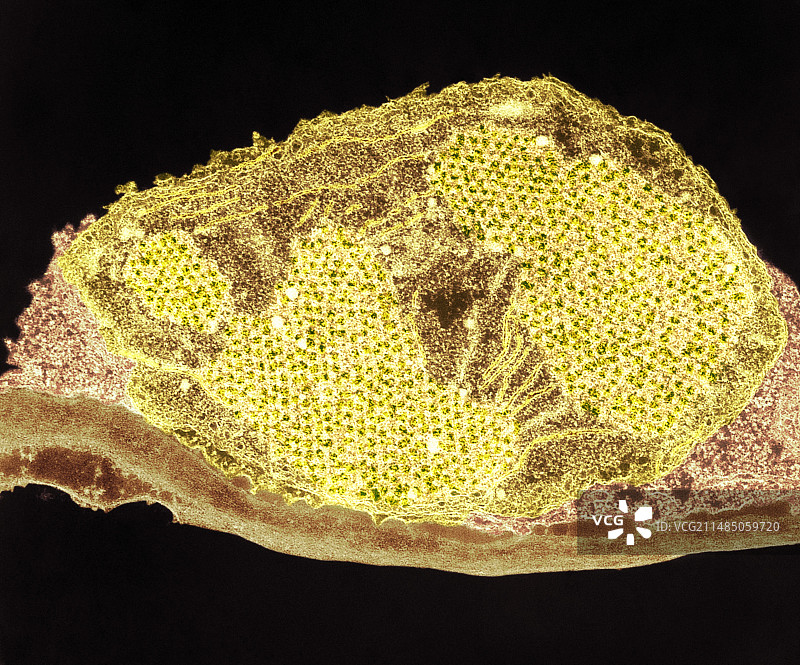 叶绿体前体，TEM图片素材