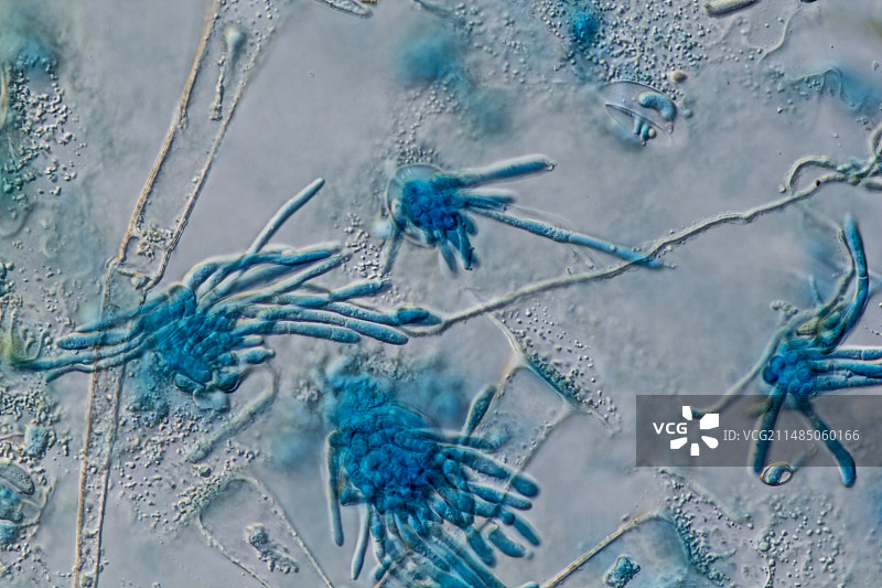 马铃薯晚疫病（Phytophtora infestans），LM图片素材