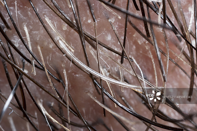 面部胡须生长图片素材