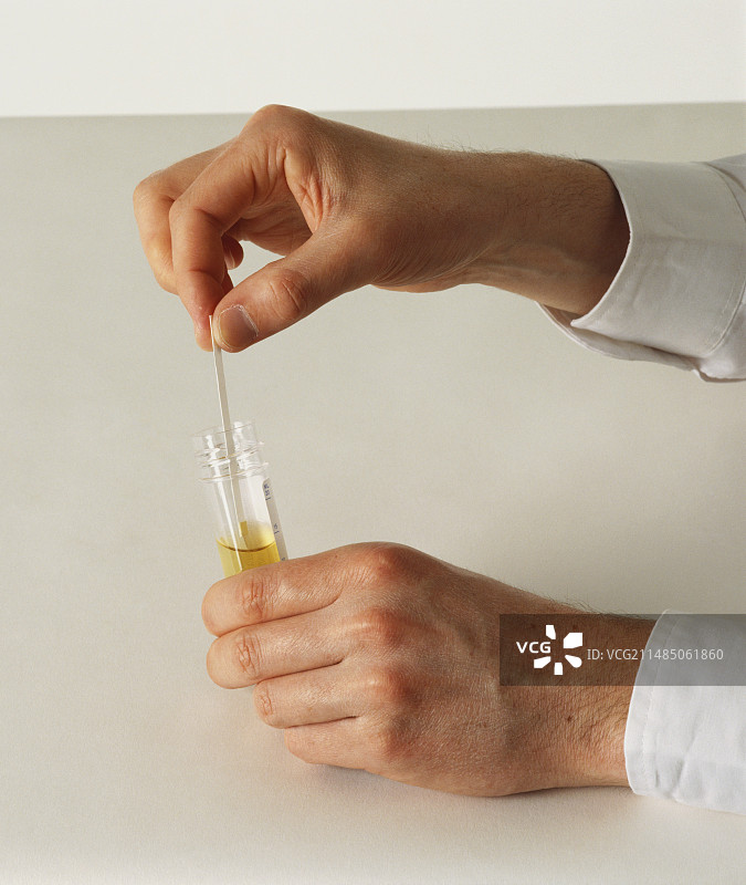 尿液样本试纸测试图片素材