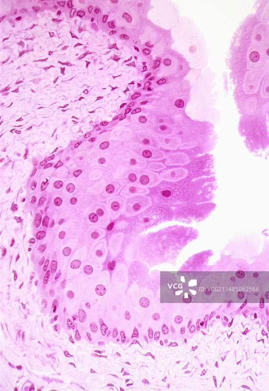 人膀胱组织样本图片素材