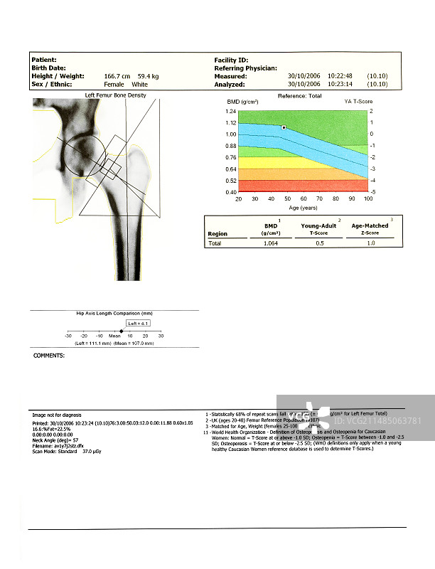 骨密度扫描图片素材