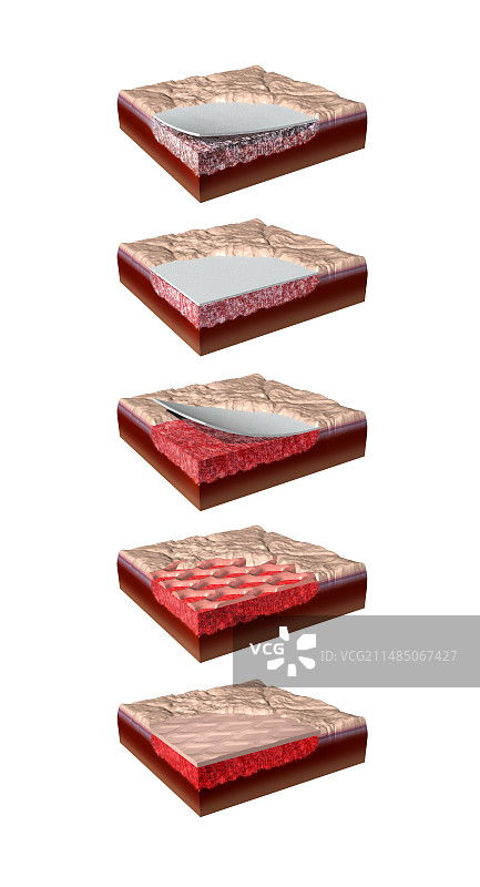 使用合成皮肤进行疗愈，艺术作品图片素材