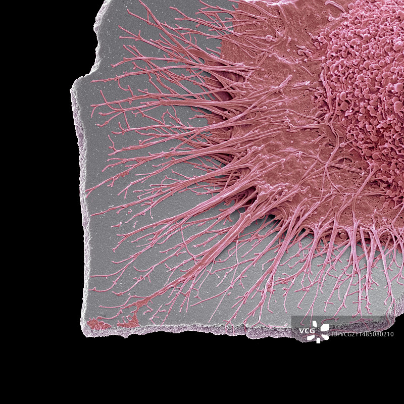 小胶质细胞白细胞扫描电镜图图片素材