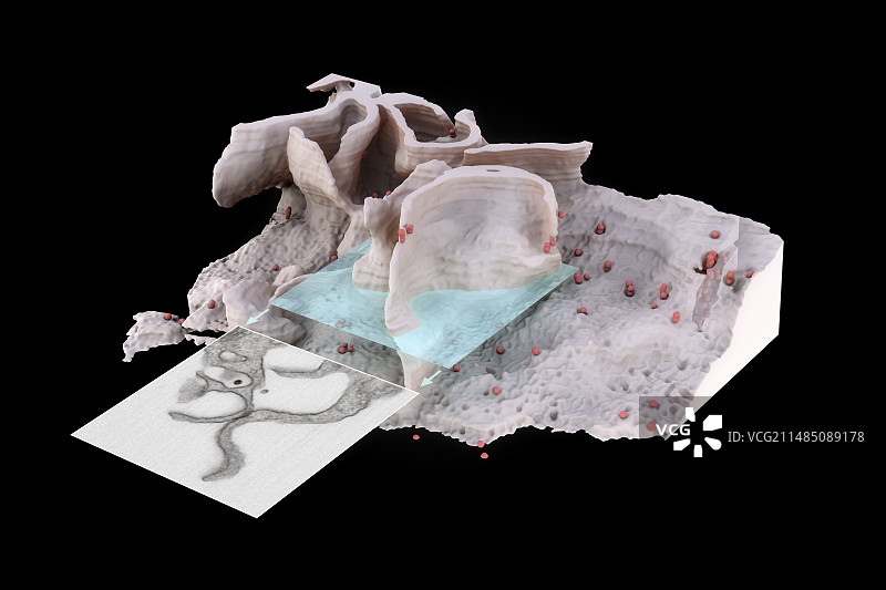 感染艾滋病毒的巨噬细胞,扫描电镜图片素材