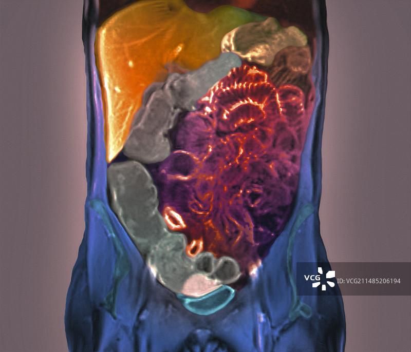 健康的腹部核磁共振扫描图片素材