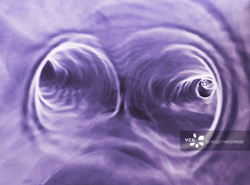 气管3D CT扫描图片素材