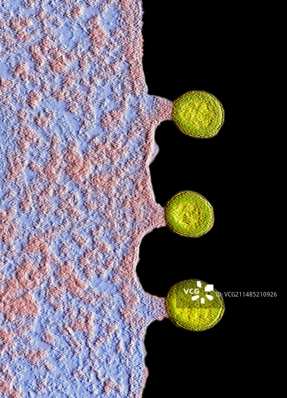 感染HIV的细胞，透射电镜图片素材