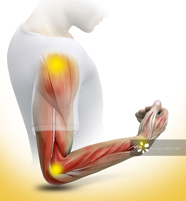 关节疼痛概念艺术作品图片素材