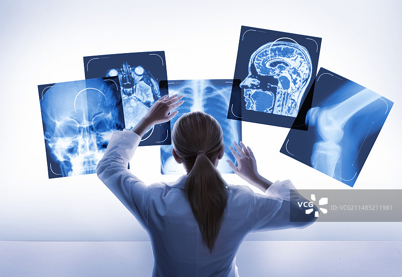 医生研究医学扫描图片素材