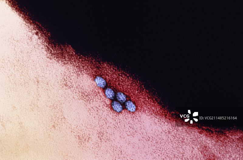 急性出血性结膜炎TEM图片素材