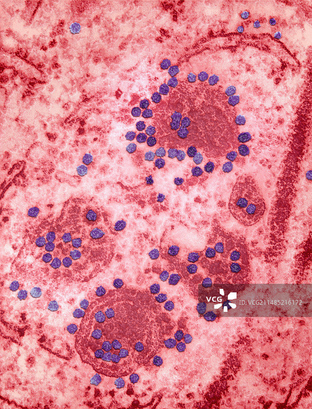 东部马脑炎病毒（TEM）图片素材