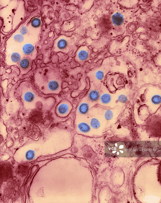 病毒感染TEM图片素材