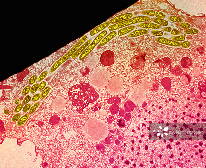 感染退伍军人菌的原生动物，透射电镜图片素材
