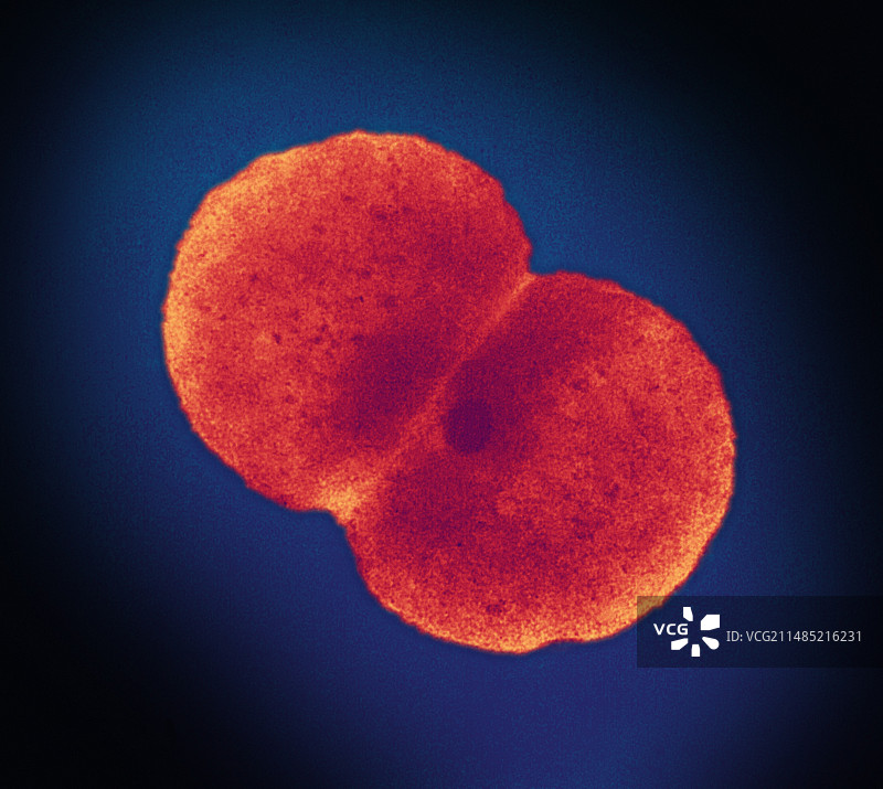 淋病细菌，透射电镜图片素材