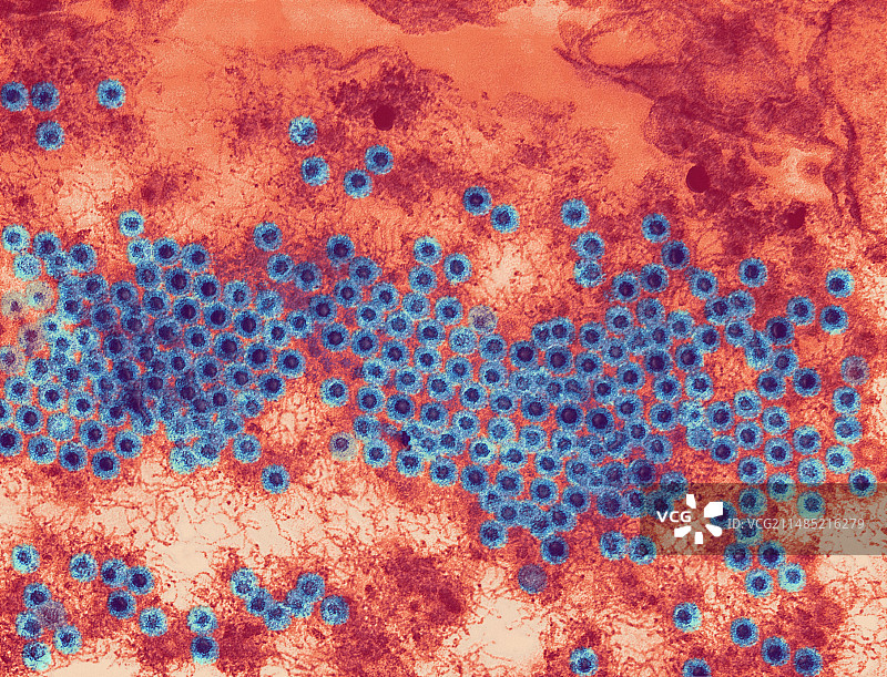 呼肠病毒颗粒，TEM图片素材