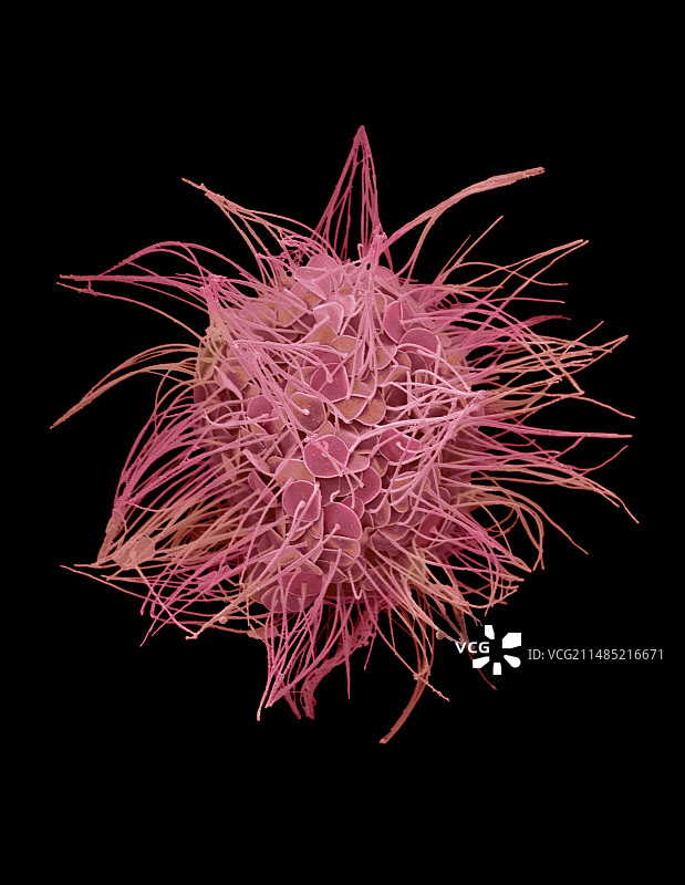 太阳虫（扫描电镜）图片素材