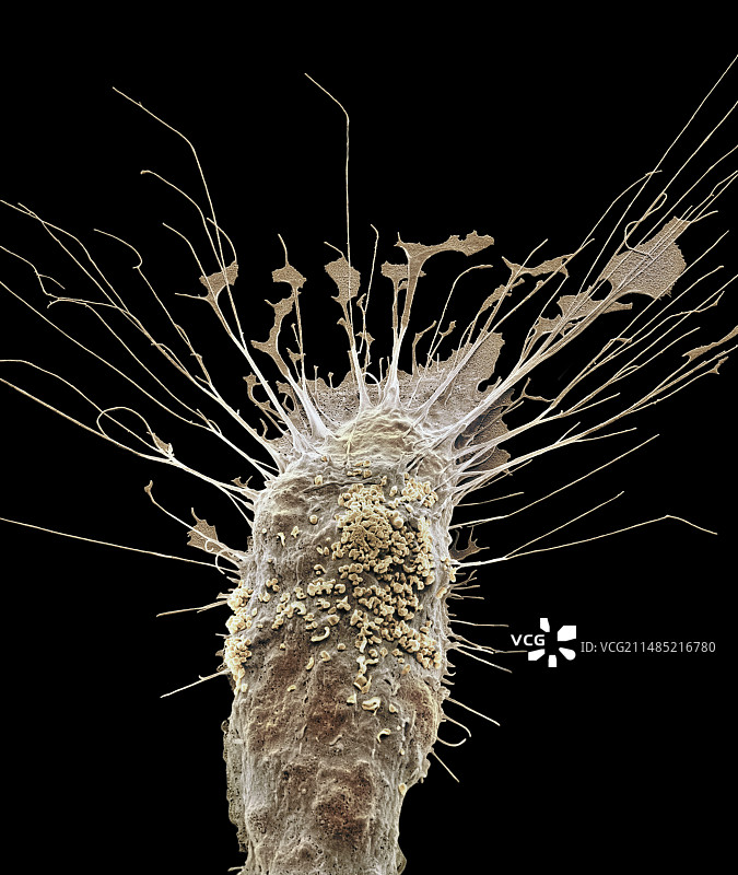 小胶质细胞白细胞扫描电镜图图片素材