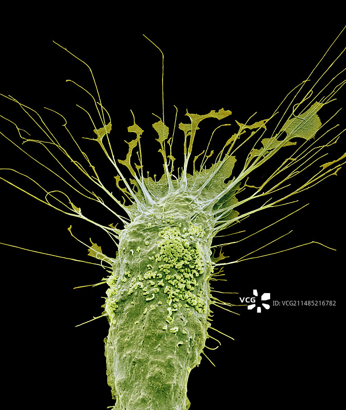 小胶质细胞白细胞扫描电镜图图片素材