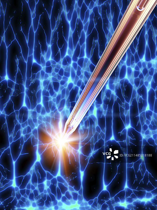 深部脑刺激与神经细胞图片素材