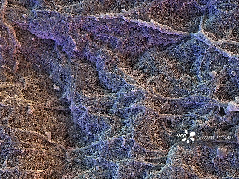 透明软骨扫描电镜图图片素材