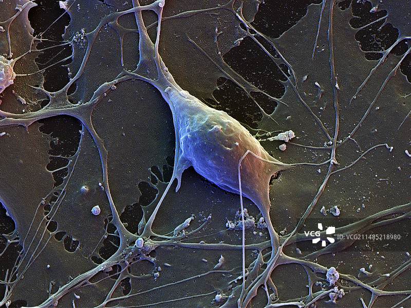 脑细胞扫描电镜图图片素材