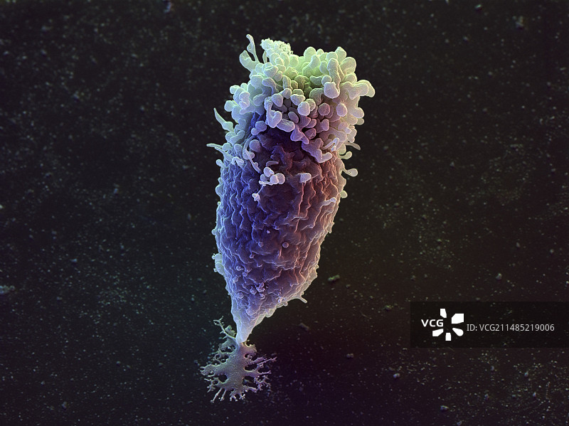 淋巴母细胞白细胞（扫描电镜）图片素材