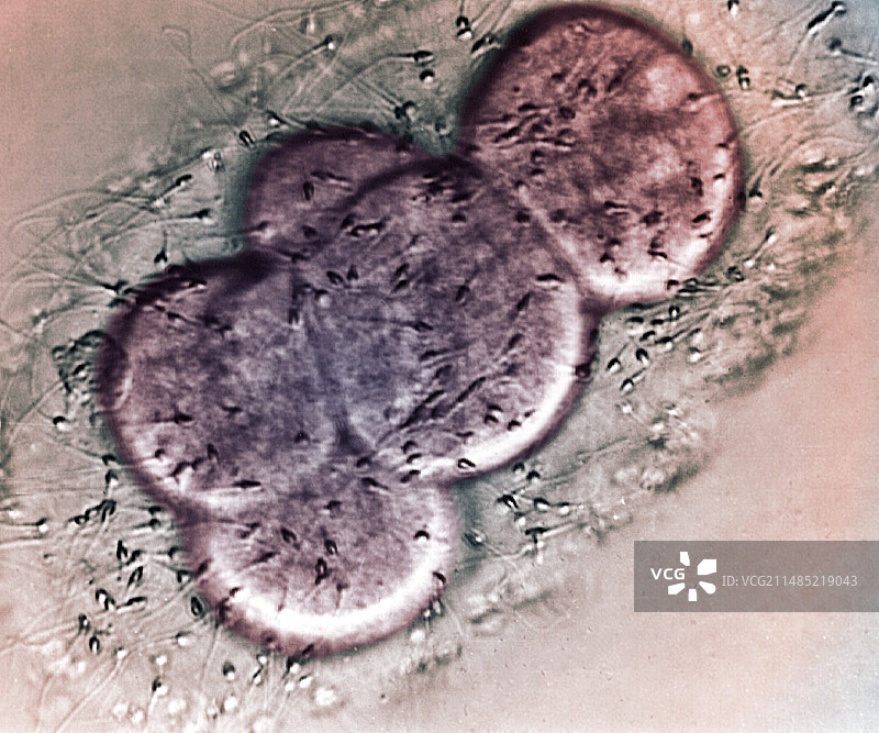 体外受精治疗，光学显微镜图片素材