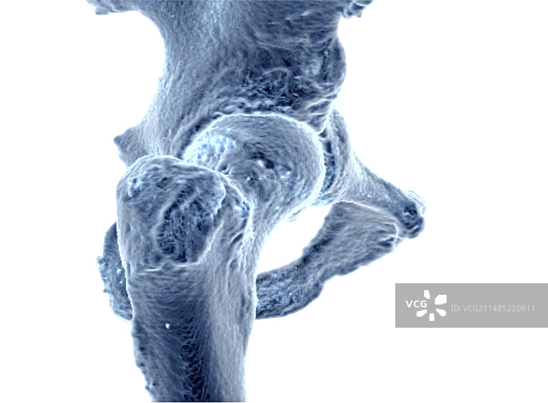 髋部MRI数据的3D骨骼重建图片素材