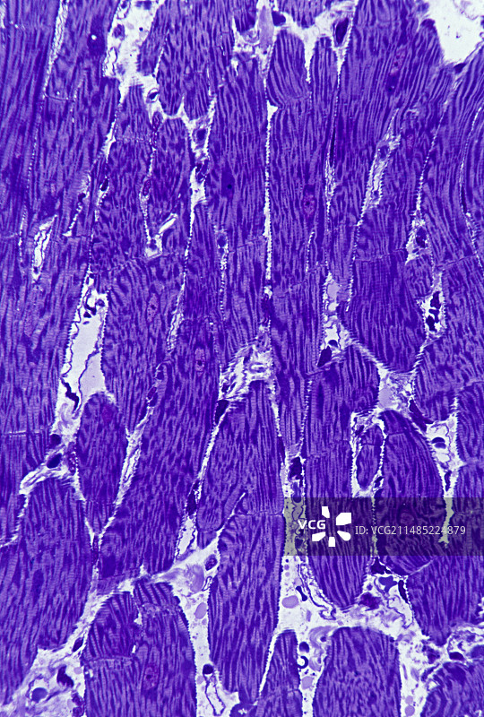 心肌组织光学显微照片图片素材