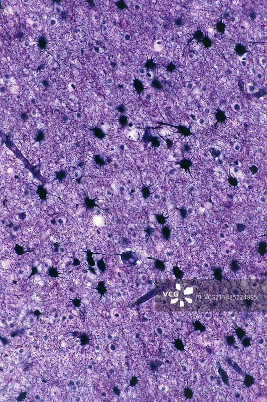 脑神经胶质细胞显微照片图片素材