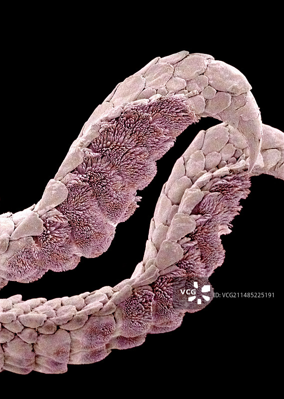 壁虎的脚，扫描电子显微镜图图片素材