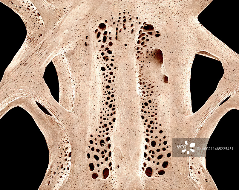鱼骨，扫描电镜图片素材