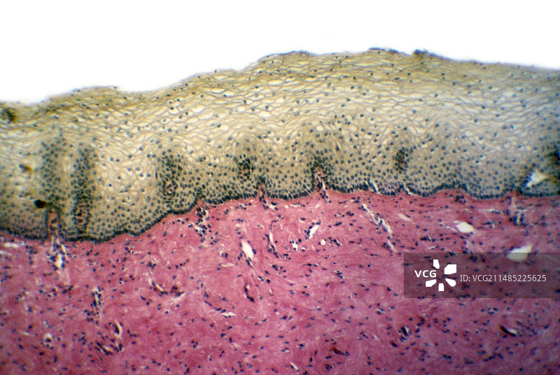阴道黏膜，光学显微照片图片素材