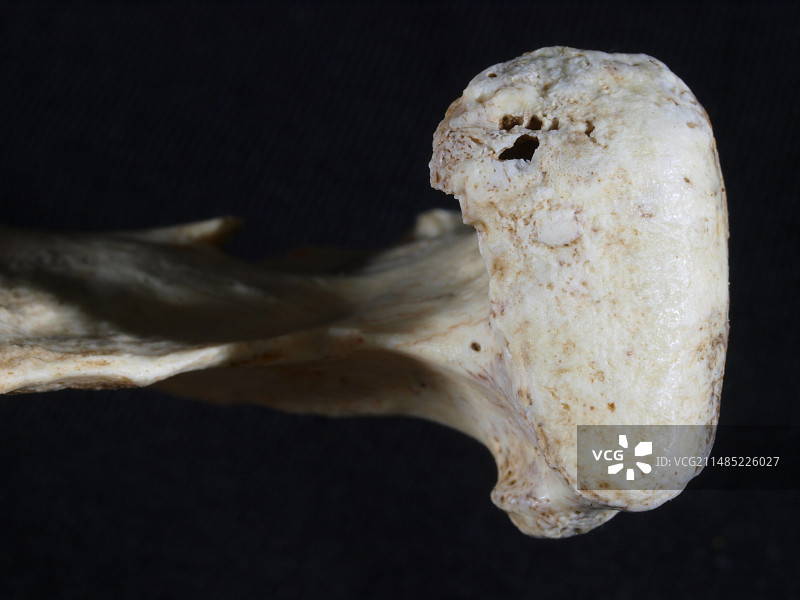 海德堡人关节炎下颌图片素材