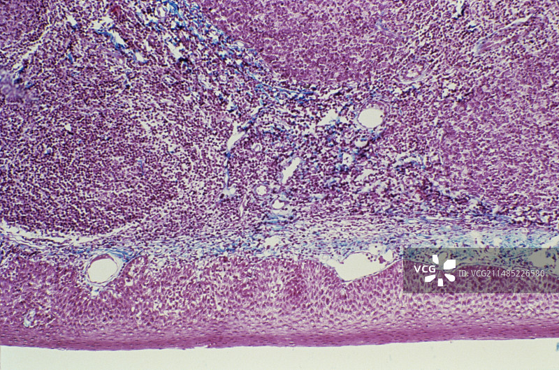 腭扁桃体，光学显微照片图片素材