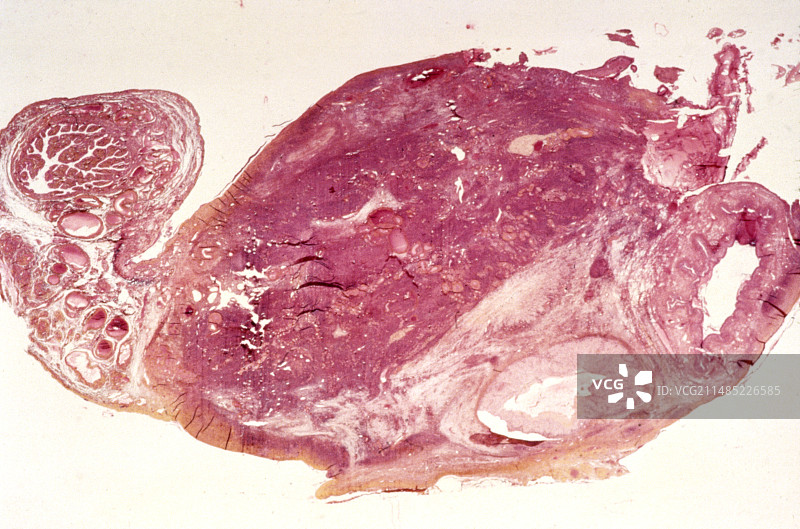 卵巢显微照片图片素材