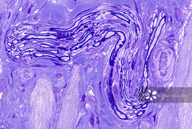 有髓神经，光学显微照片图片素材