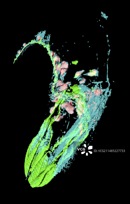 秀丽隐杆线虫显微照片图片素材