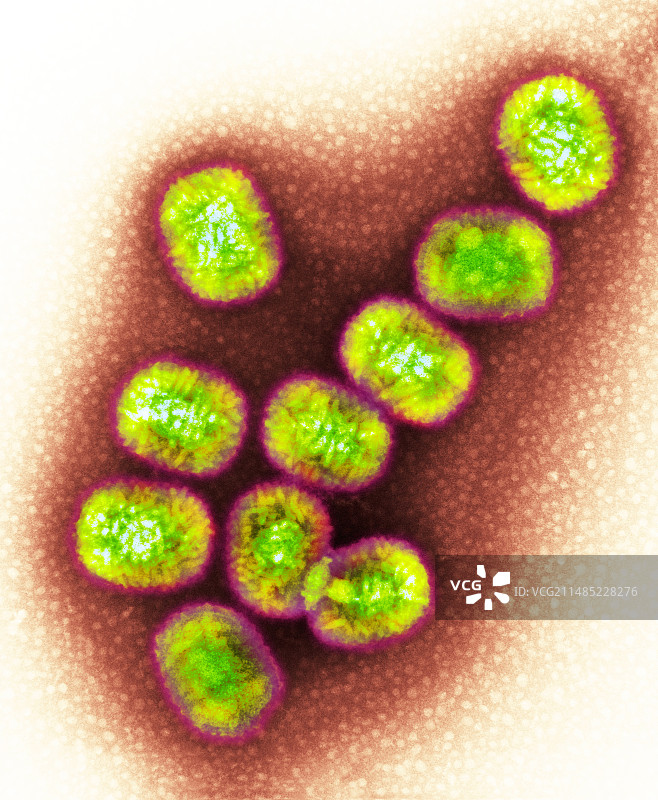传染性软疣病毒TEM图片素材