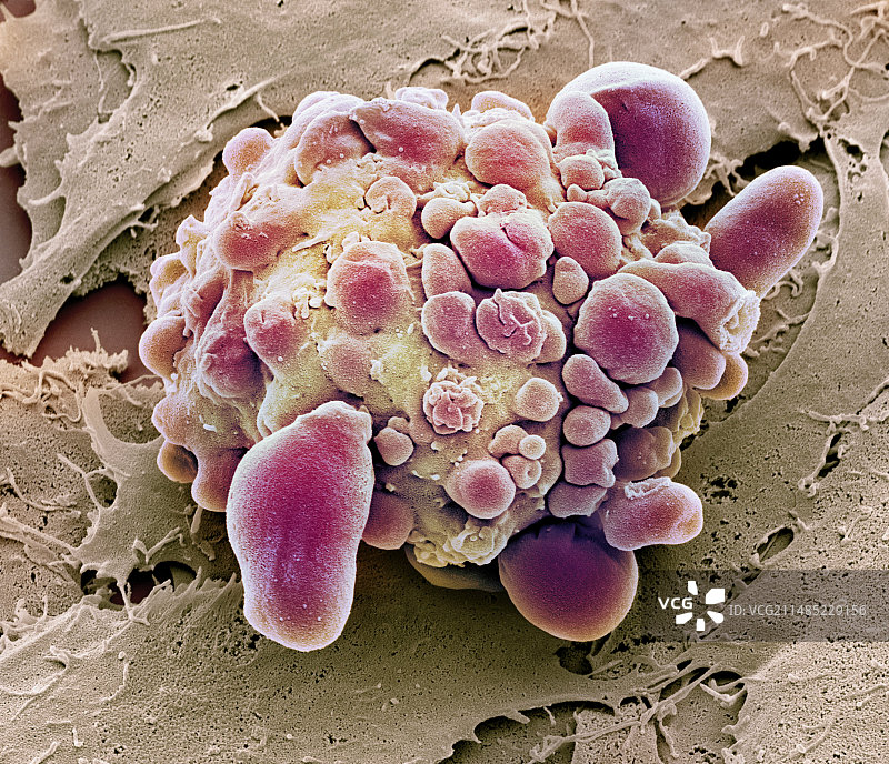 垂死的干细胞，扫描电子显微镜图片素材