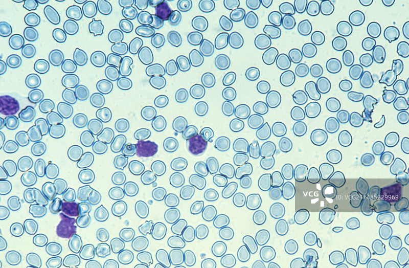 血细胞显微照片图片素材
